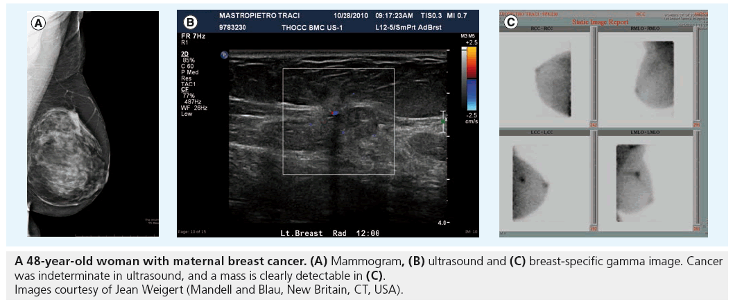 imaging-in-medicine-breast-cancer