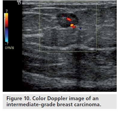 imaging-in-medicine-breast-carcinoma