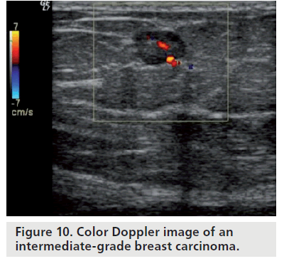 Doppler Ultrasound Color Chart