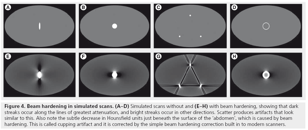 imaging-in-medicine-bright-streaks