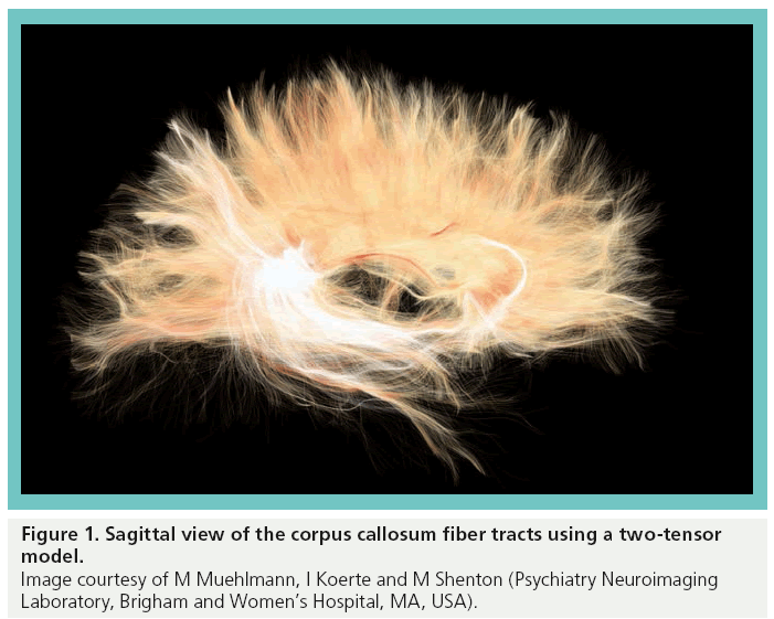 imaging-in-medicine-callosum-fiber