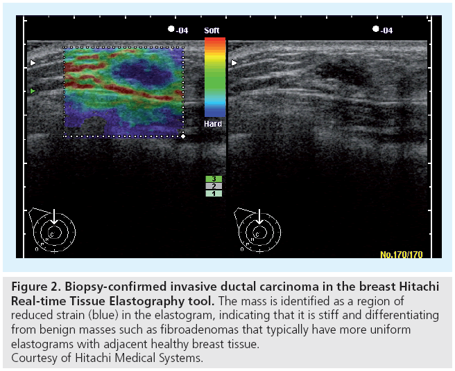 imaging-in-medicine-carcinoma