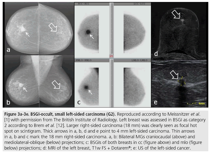 imaging-in-medicine-carcinoma