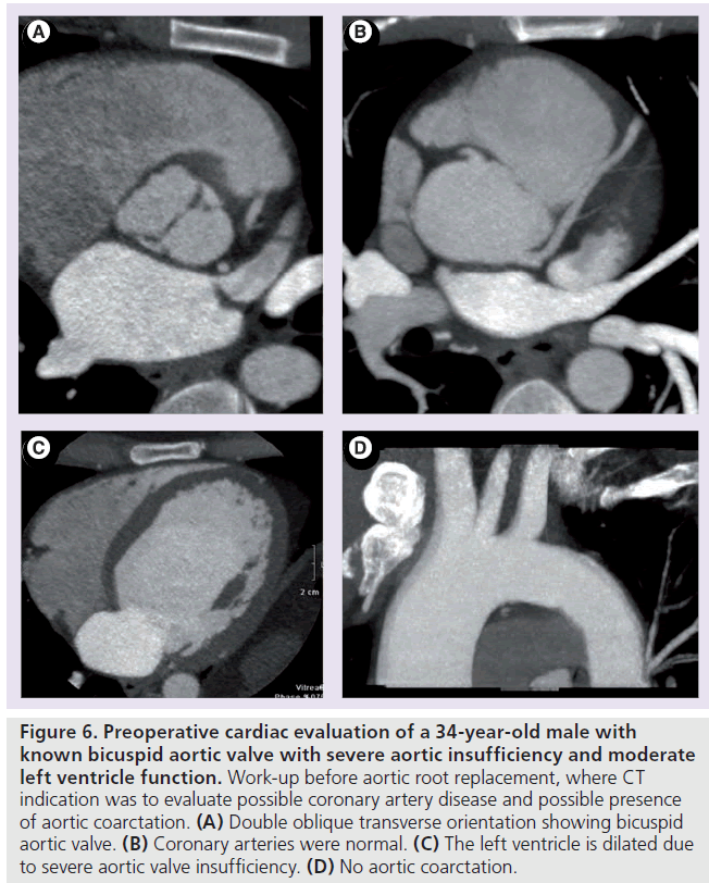 imaging-in-medicine-cardiac-evaluation