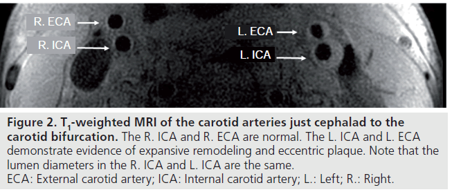 imaging-in-medicine-carotid-arteries