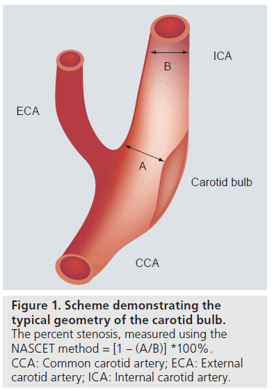 imaging-in-medicine-carotid-bulb