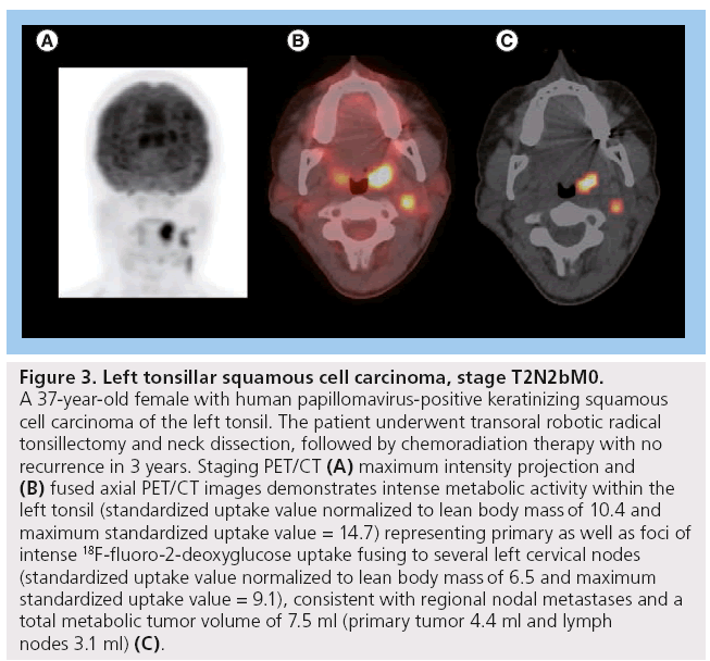 imaging-in-medicine-cell-carcinoma