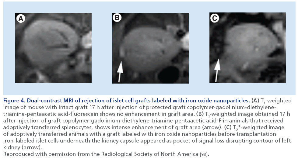 imaging-in-medicine-cell-grafts