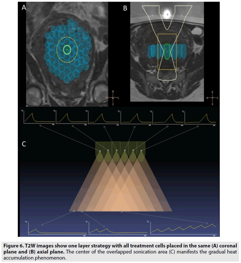 imaging-in-medicine-cells-placed