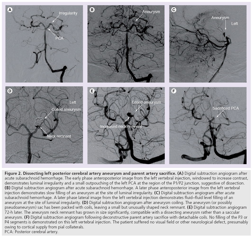 imaging-in-medicine-cerebral-artery