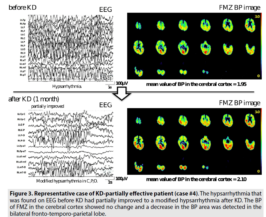 imaging-in-medicine-cerebral-cortex