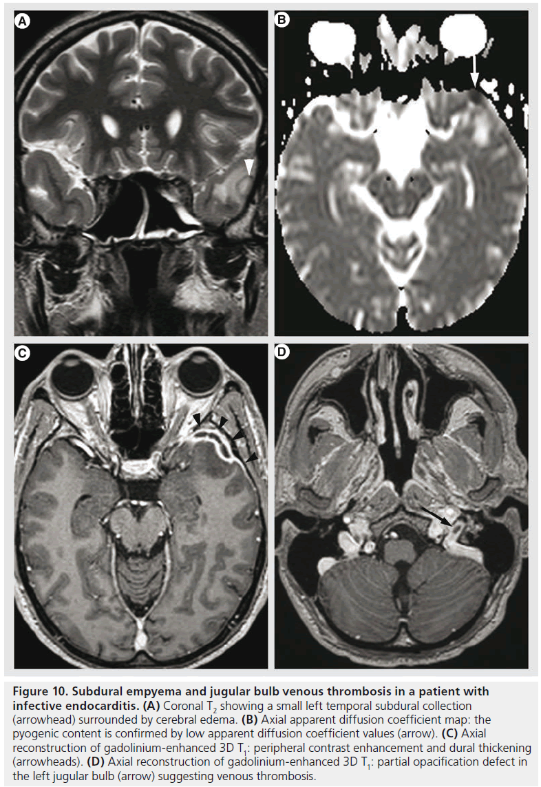 imaging-in-medicine-cerebral-edema