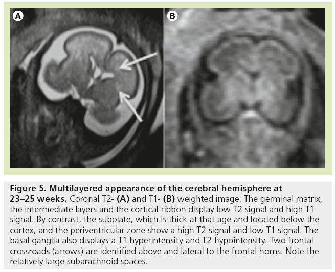 imaging-in-medicine-cerebral-hemisphere