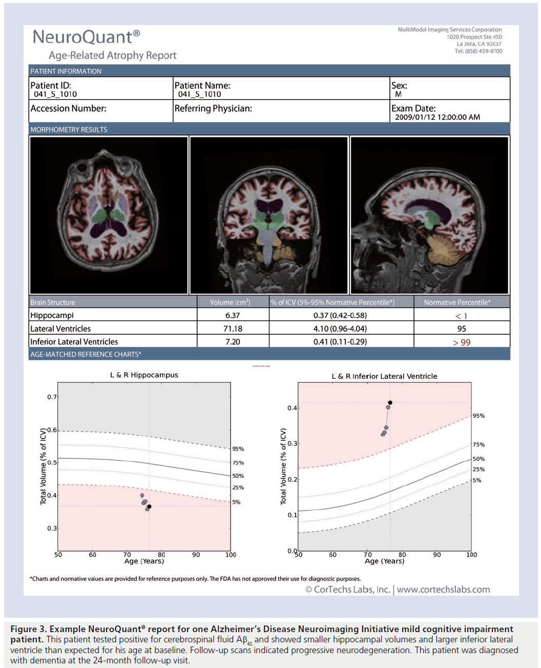 imaging-in-medicine-cerebrospinal-fluid