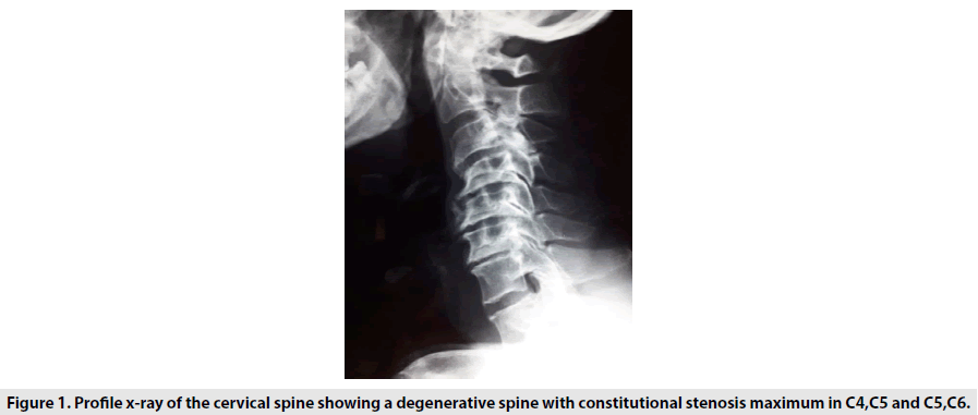 imaging-in-medicine-cervical-spine