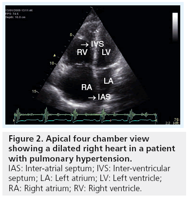 imaging-in-medicine-chamber-view