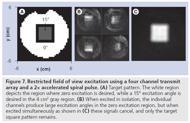 imaging-in-medicine-channel-transmit