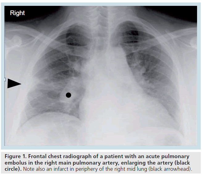 imaging-in-medicine-chest-radiograph