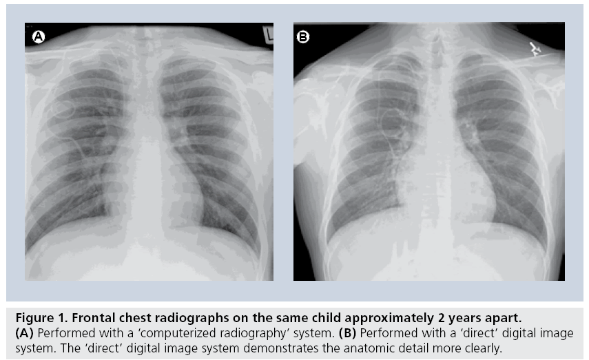 imaging-in-medicine-chest-radiographs