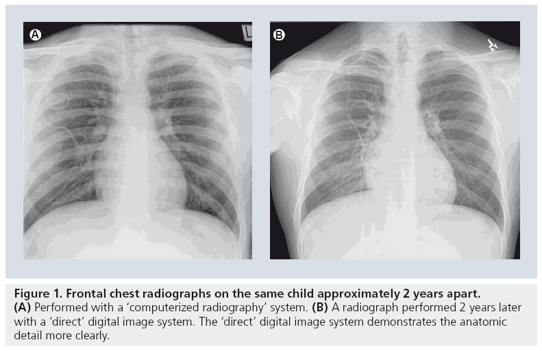 imaging-in-medicine-chest-radiographs
