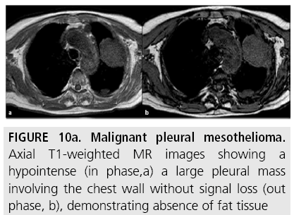 imaging-in-medicine-chest-wall