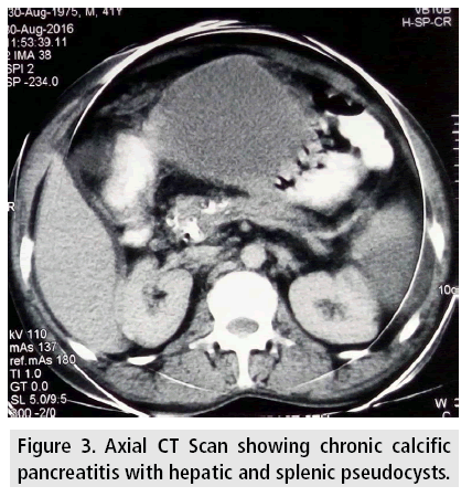 imaging-in-medicine-chronic-calcific