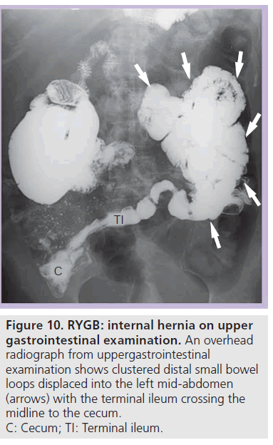 imaging-in-medicine-clustered-distal