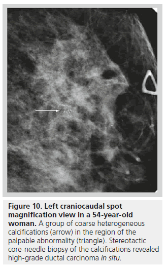 imaging-in-medicine-coarse-heterogeneous