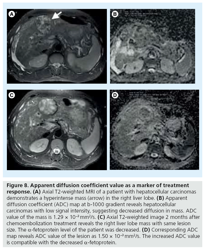 imaging-in-medicine-coefficient-value