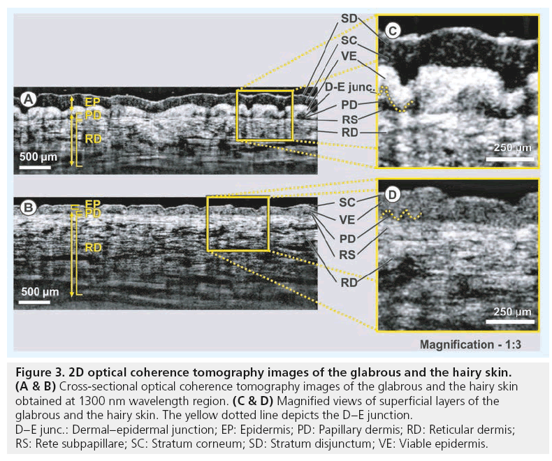imaging-in-medicine-coherence-tomography
