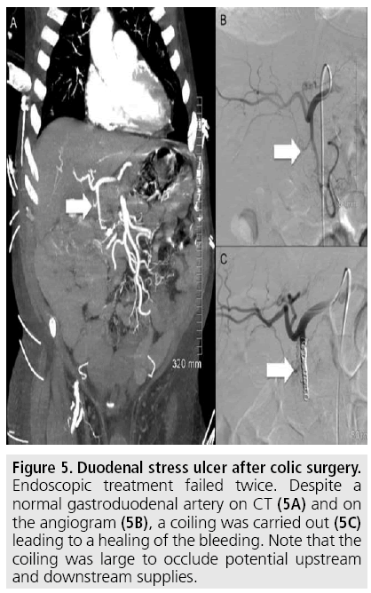 imaging-in-medicine-colic-surgery