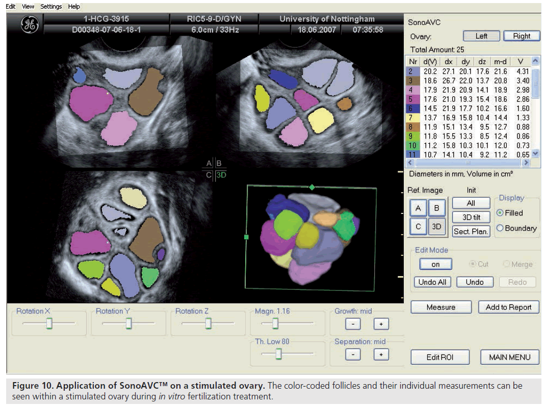 imaging-in-medicine-color-coded 