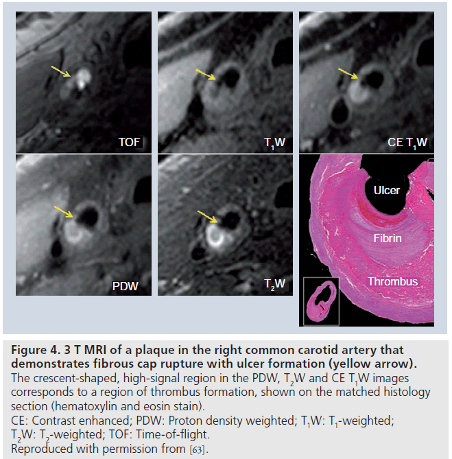 imaging-in-medicine-common-carotid