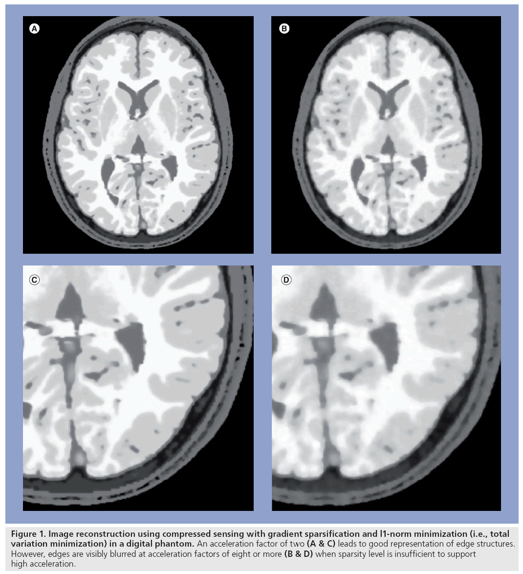 imaging-in-medicine-compressed-sensing