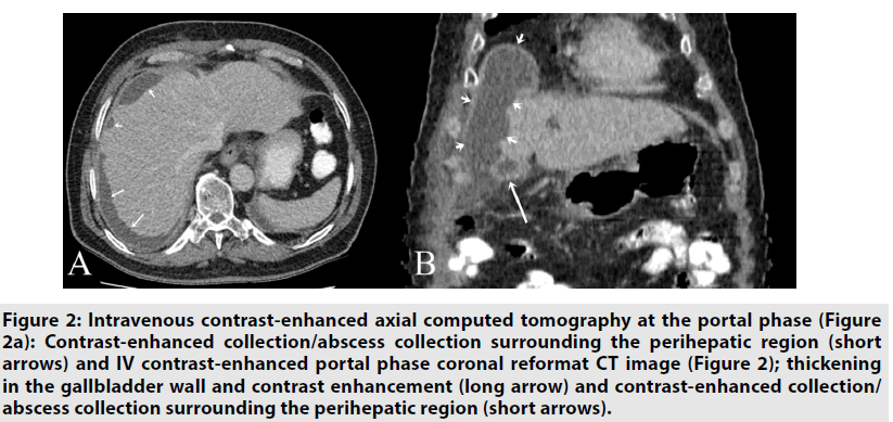 imaging-in-medicine-computed-tomography