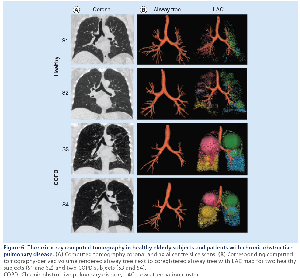 imaging-in-medicine-computed-tomography