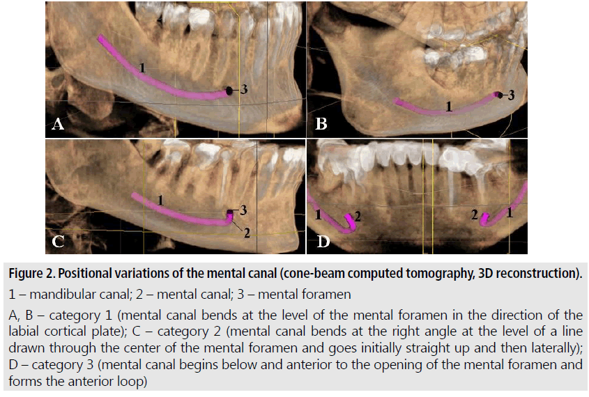 imaging-in-medicine-computed-tomography
