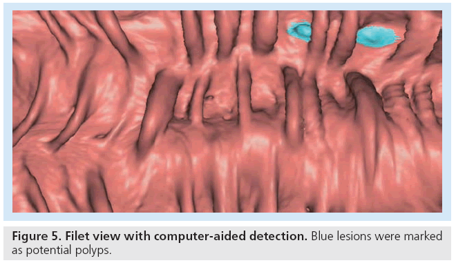 imaging-in-medicine-computer-aided