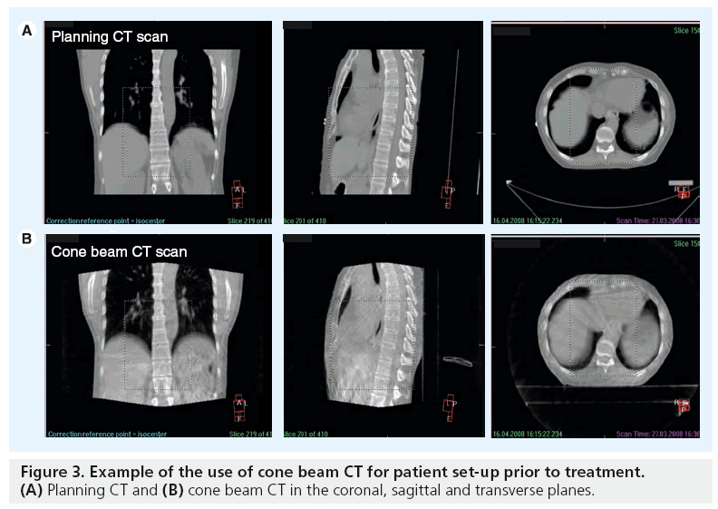 imaging-in-medicine-cone-beam