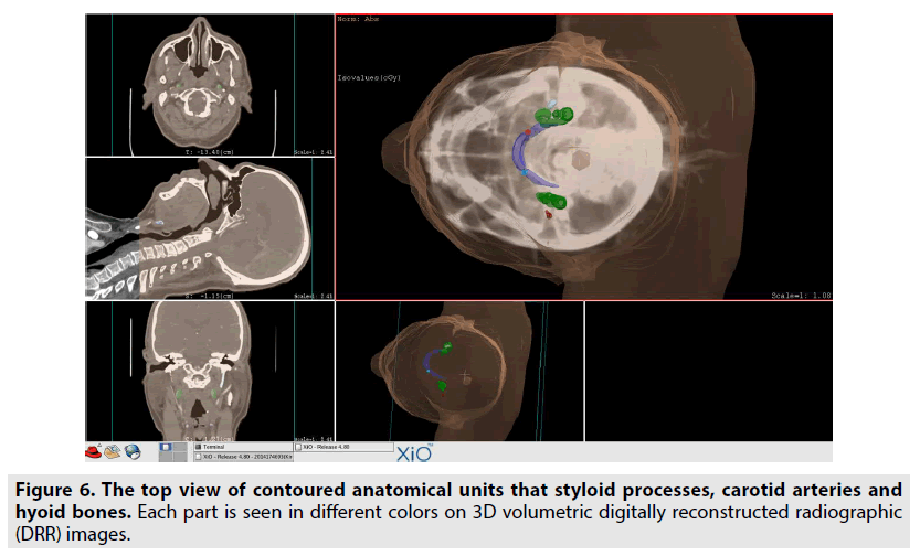 imaging-in-medicine-contoured-anatomical