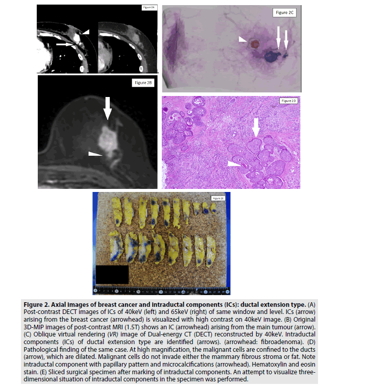 imaging-in-medicine-contrast