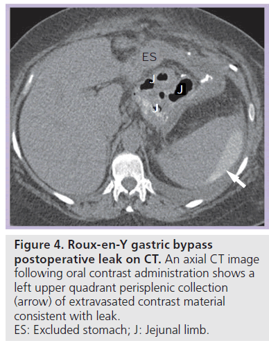 imaging-in-medicine-contrast-administration