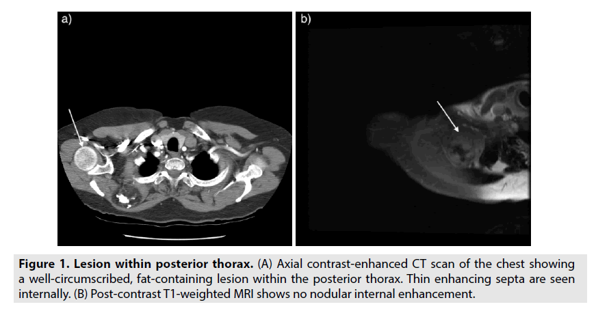 imaging-in-medicine-contrast-enhanced