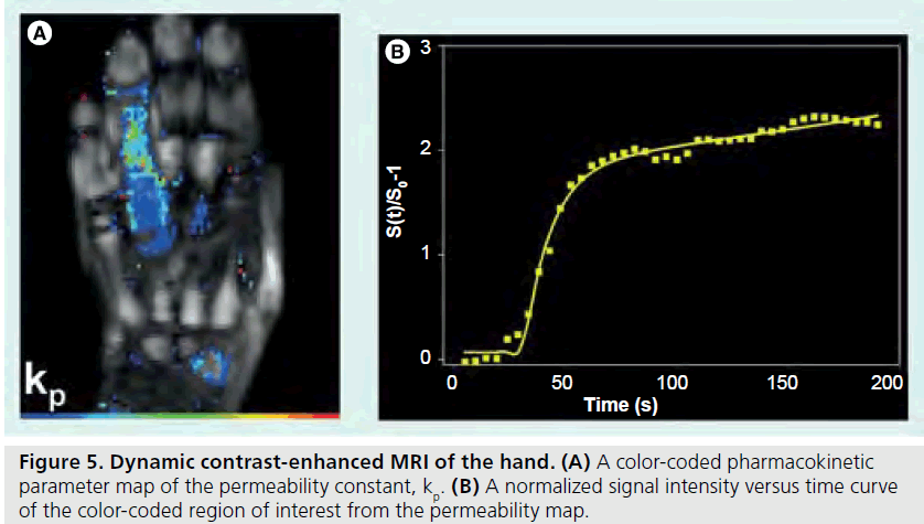 imaging-in-medicine-contrast-enhanced