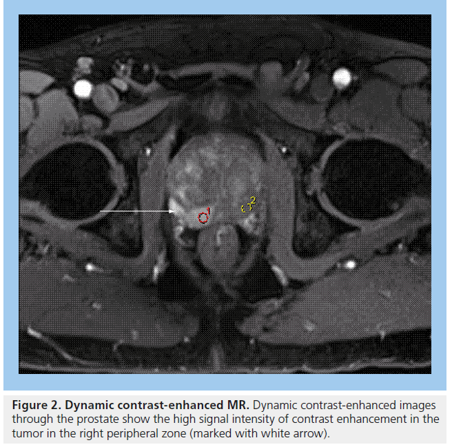 imaging-in-medicine-contrast-enhanced