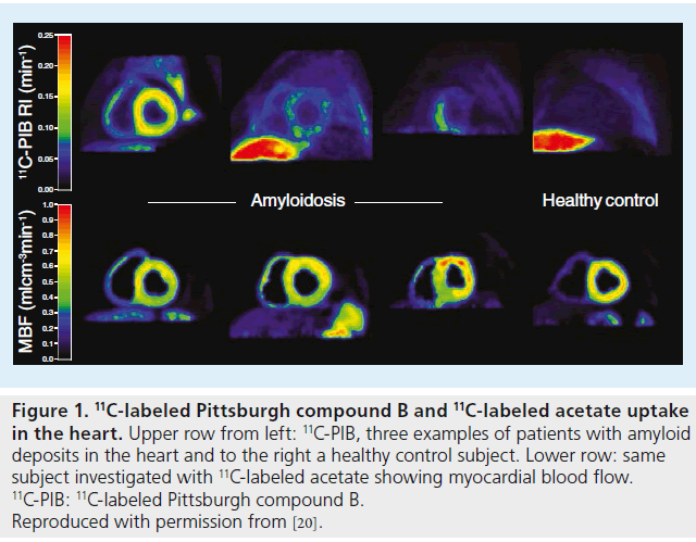 imaging-in-medicine-control-subject