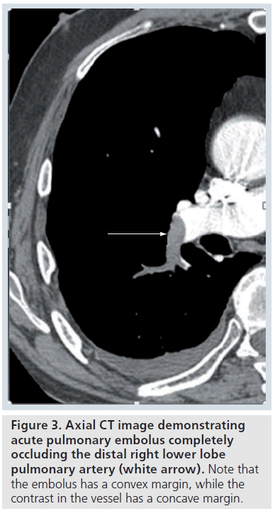 imaging-in-medicine-convex-margin