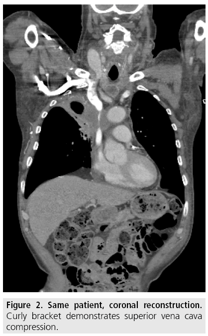 imaging-in-medicine-coronal