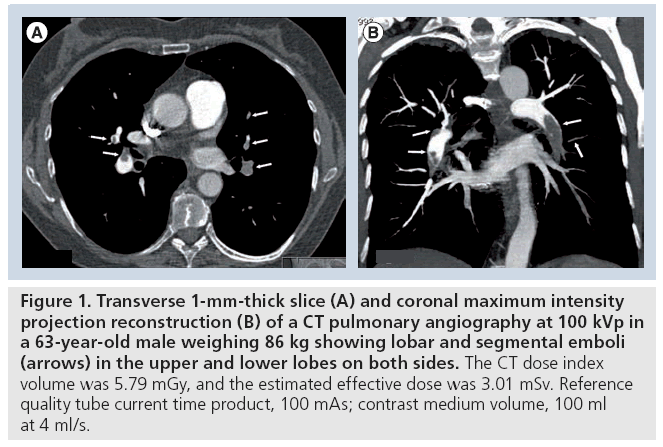 imaging-in-medicine-coronal-maximum