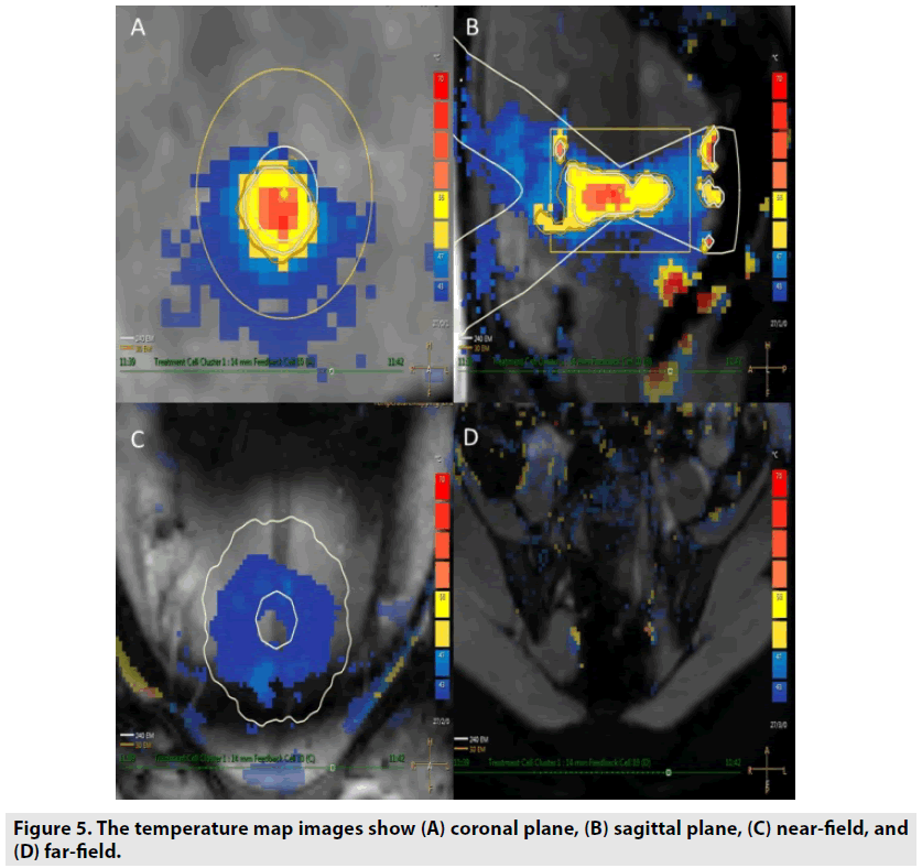 imaging-in-medicine-coronal-plane